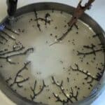 Doktor tvrdi da se Grafen prebacuje sa vakcinisanih na nevakcinisane izazivajući čudne krvne ugruške