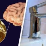 SAD: Smrt muškarca nakon zaraze smrtonosnom infekcijom koja jede mozak