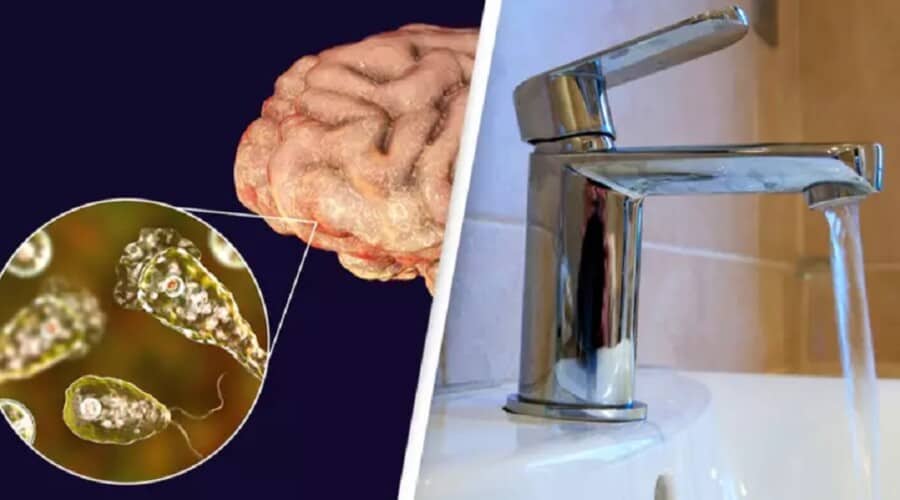 SAD: Smrt muškarca nakon zaraze smrtonosnom infekcijom koja jede mozak