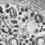 CDC upozorava na smrtonosni Marburg virus, evo kako je ova bolest blisko povezana sa Srbijom