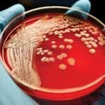 Insekti u ishrani su ništa šta su tek isplanirali "naučnici"- Za ručak gulaš od fermentisanih mikroba