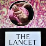 LANCET nastavlja sa promocijom abortusa: "Novorođenčad nemaju dostojanstvo, mogu se odbaciti po volji"