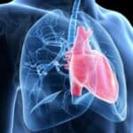 Globalni porast kardiovaskularnih smrti – ali nema pomena o vakcinama