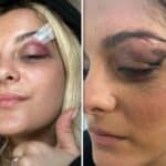 "Orao pao, orao pao"! Albanska pevačica dobila telefon u glavu nakon što je na koncertu pokazala velikoalbanski simbol (VIDEO)