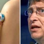 Bil Gejts razvija mRNA „flastere“ umesto klasičnih vakcina koji će biti dostupni svima