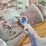 Devojka(16) se bori za život jer joj je odbijena transplantacija pluća zato što nije primila 4 vakcine protiv COVID-a