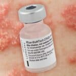 Novi izveštaj: COVID vakcine pokazuju 24 puta više neželjenih reakcija od drugih vakcina