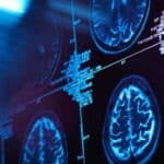 TRANSHUMANIZAM: Vlada Australije finansira naučnike koji spajaju veštačku inteligenciju sa moždanim ćelijama