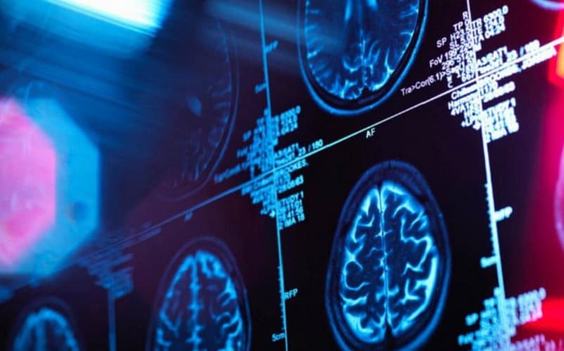  TRANSHUMANIZAM: Vlada Australije finansira naučnike koji spajaju veštačku inteligenciju sa moždanim ćelijama
