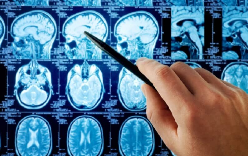  Kina predstavila ‘neuralno oružje’ koje može da ‘napadne i kontroliše mozak’ iako je hiljadama kilometara daleko
