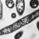 POLJSKA pokrenula hitnu istragu nakon više smrtnih slučajeva VIRUSA Legionela - Varšava upire prst u Rusiju