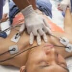 Smrtnost od srčanog udara porasla za 30% kod mladih ljudi od 2020. godine – glavni mediji zbunjeni