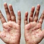 Majmunske boginje se šire KINOM - Peking najavljuje moguća zaključavanja