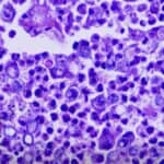 Mediji najavlju "Apokalipsu" gljivičnih oboljenja i naravno za sve su krive "klimatske promene"