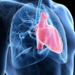 Kako je miokarditis postao cenzurisana nuspojava vakcinacije protiv COVID-19