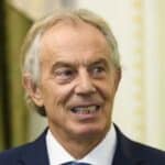 Toni Bler: „Morate da znate ko je vakcinisan, a ko nije“