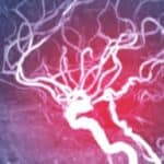 Naučnici tvrde- Laboratorijski uzgojeni krvni sudovi bi mogli da spreče infarkt