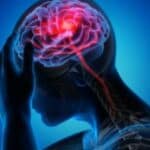 Studija: Moždani udar bi mogao biti prenosiv transfuzijom