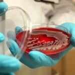 Superbakterije ubijaju više od 30.000 Evropljana svake godine