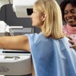 Studija: Mamografi povezani sa porastom smrtnosti od 84% od raka dojke