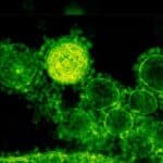 Aljaska potvrdila prvi smrtni slučaj od aljaskih boginja