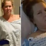 Komičarka Ejmi Šumer kaže da je razvila VAIDS nakon trećeg bustera