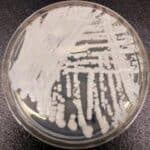 U državi Vašington potvrđeno prvo izbijanje smrtonosne gljivične infekcije