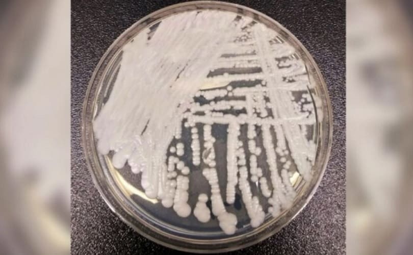  U državi Vašington potvrđeno prvo izbijanje smrtonosne gljivične infekcije