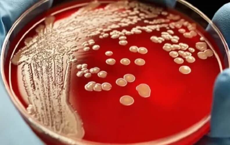 Pandemija 2.0: CDC upozorava da će „super gonoreja“ biti sledeća pandemija iz Kine
