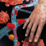 Novi mutantni soj majmunskih boginja sa 'pandemijskim potencijalom' otkriven u Kongu