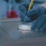 COVID-19 povezan sa „alarmantnim porastom“ retke i visoko smrtonosne gljivične infekcije