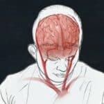 Koledž lekara i hirurga tvrdi da oni koji odbijaju vakcinu moraju da se leče psihijatrijskim lekovima