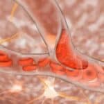 Dr Džon Kembel analizirao studiju slučaja koja pokazuje moždane udare i smrt nakon mRNA injekcije protiv Covid-a