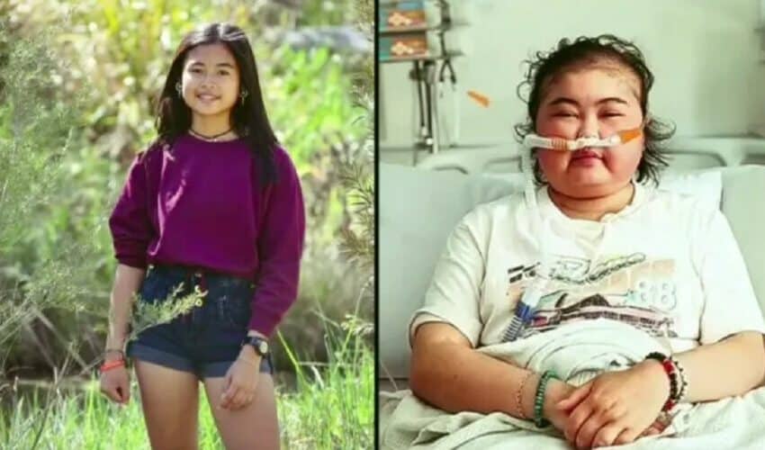  UŽAS u Australiji: Bolnica odbila da spasi devojčicu obolelu od raka jer nije vakcinisana! Imala je samo 17 godina