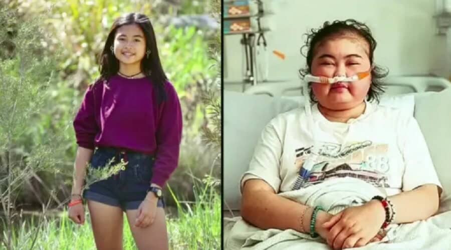 UŽAS u Australiji: Bolnica odbila da spasi devojčicu obolelu od raka jer nije vakcinisana! Imala je samo 17 godina