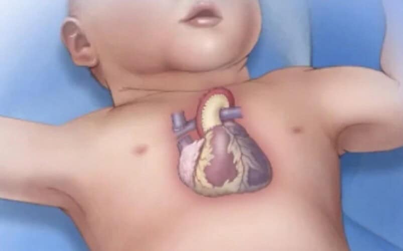 Globalni porast srčane insuficijencije kod dece izazvan vakcinama protiv Covid-a, potvrđuje studija