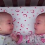 Studija: Izlečen autizam kod devojčica bliznakinja kroz životni stil i promene životne sredine