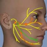 Studija: Sve veći broj paraliza lica izazvanih vakcinama protiv Covid-a