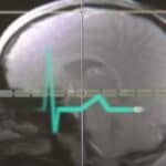 Liberali krive Putina za Bajdenov debakl u debati: Pogođen je Putinovim „oružjem sa usmerenom energijom“