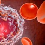 Doktor upozorava na dramatičan porast dijagnostikovanja turbo karcinoma svake nedelje