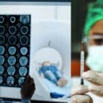 Broj umrlih od neuroloških oboljenja raste među vakcinisanima protiv COVID-a otkriva najnovija studija