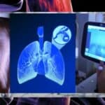 Nova uredba EU o zdravstvenim podacima ugrožava privatnost i bezbednost