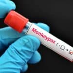 Oprobana "taktika"! Kina uvela obavezne pregleda za putnike zbog MAJMUNSKIH BOGINJA