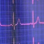 32-godišnjakinja iznenada preminula od srčanog zastoja nakon vakcine protiv Covida