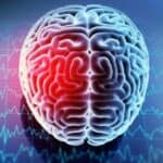 Prepoznavanje ranih znakova upozorenja na moždani udar i kako ga sprečiti