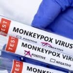 Singapur pokreće kampanju vakcinacije protiv majmunskih boginja u stilu Covid-a