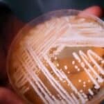 Smrtonosne epidemije gljivica u porastu, Blumberg upozorava: Krivi su COVID i globalno zagrevanje