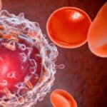 Korporativni mediji ne mogu više da ignorišu neviđeni porast slučajeva „Turbo raka“