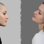 Šta uzrokuje opadanje kose? Glavni krivci i kako ih sprečiti