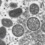 Gvineja prijavila preko 200 slučajeva majmunskih boginja, bolest se širi Zapadnom Afrikom